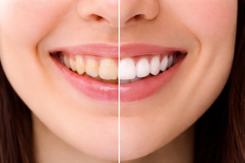 Plan Dental
